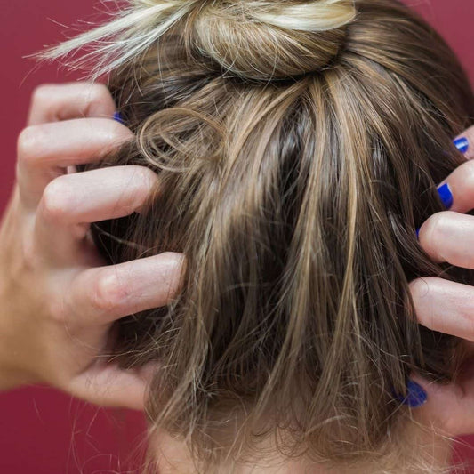 Hair Extensions Causing Itchy Scalp